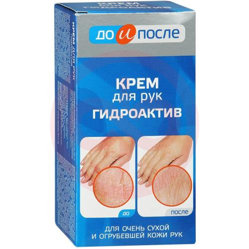 Крем Для Сухой Кожи Рук В Аптеке Крем Для Сухой Кожи Рук В Аптеке